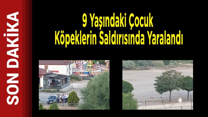 9 Yaşındaki Çocuk Köpeklerin Saldırısında Yaralandı