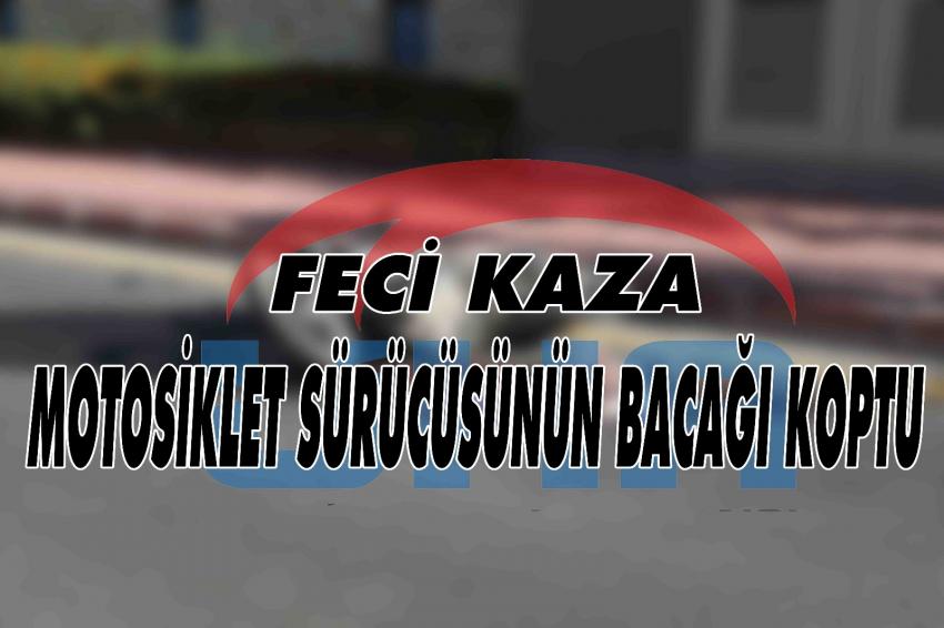 Feci Kazada Motosiklet Sürücüsünün Bacağı Koptu